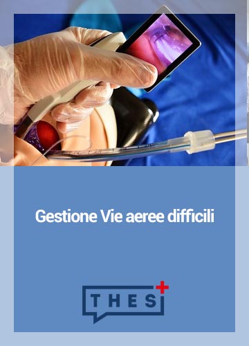 Gestione vie aeree